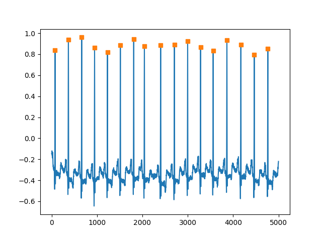 01 algorithms qrs detection
