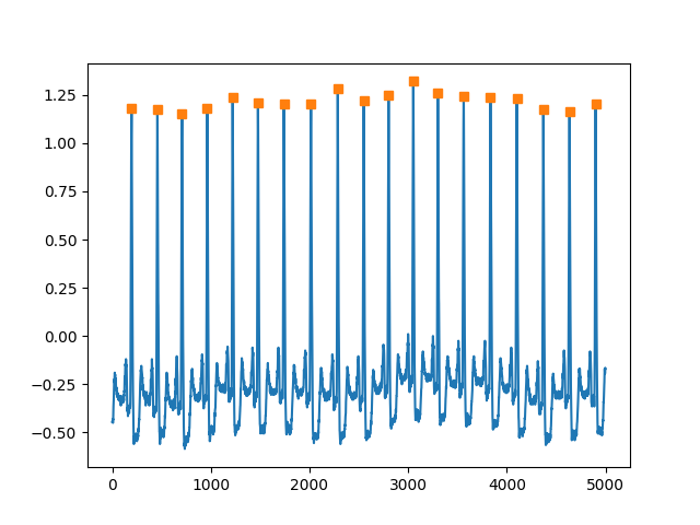 01 algorithms qrs detection